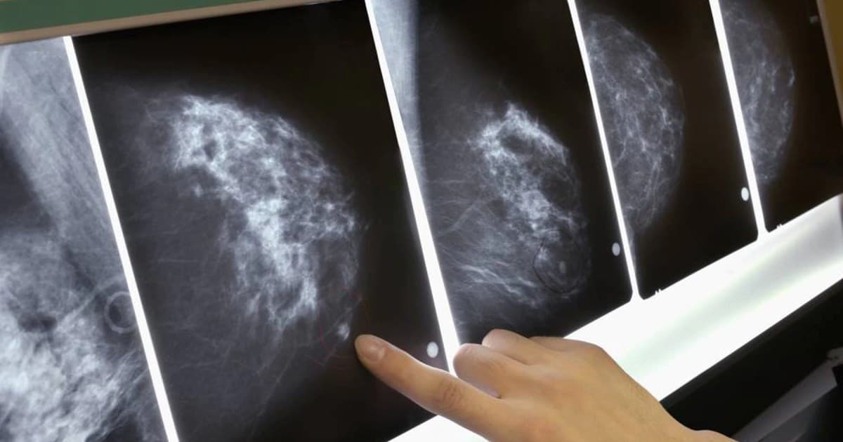 Viedma tendrá licencia laboral de dos días para estudios de detección de cáncer